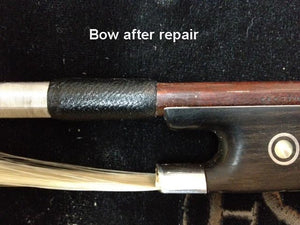 Restoration Repair for Thumb Wear